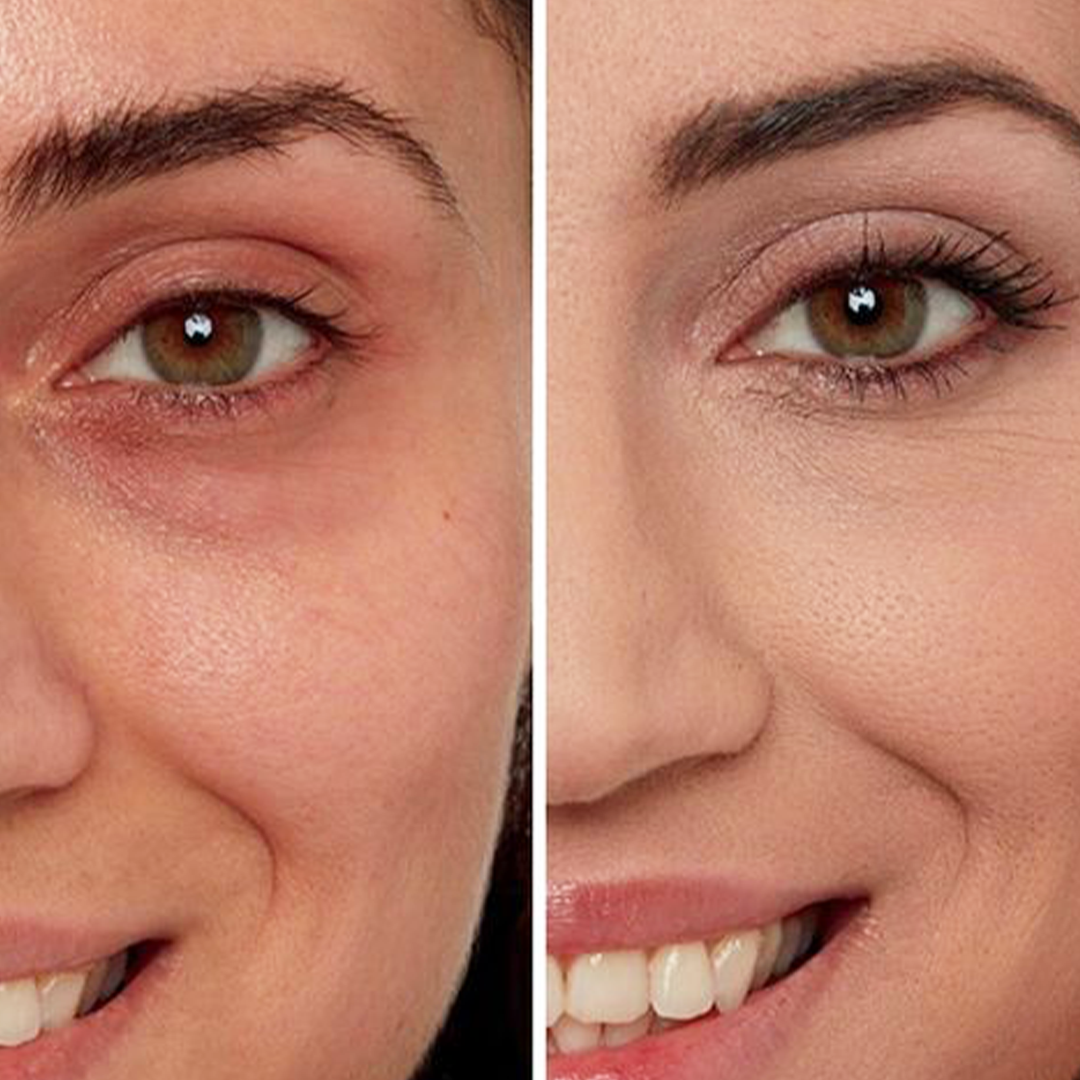 Under Eye Cream