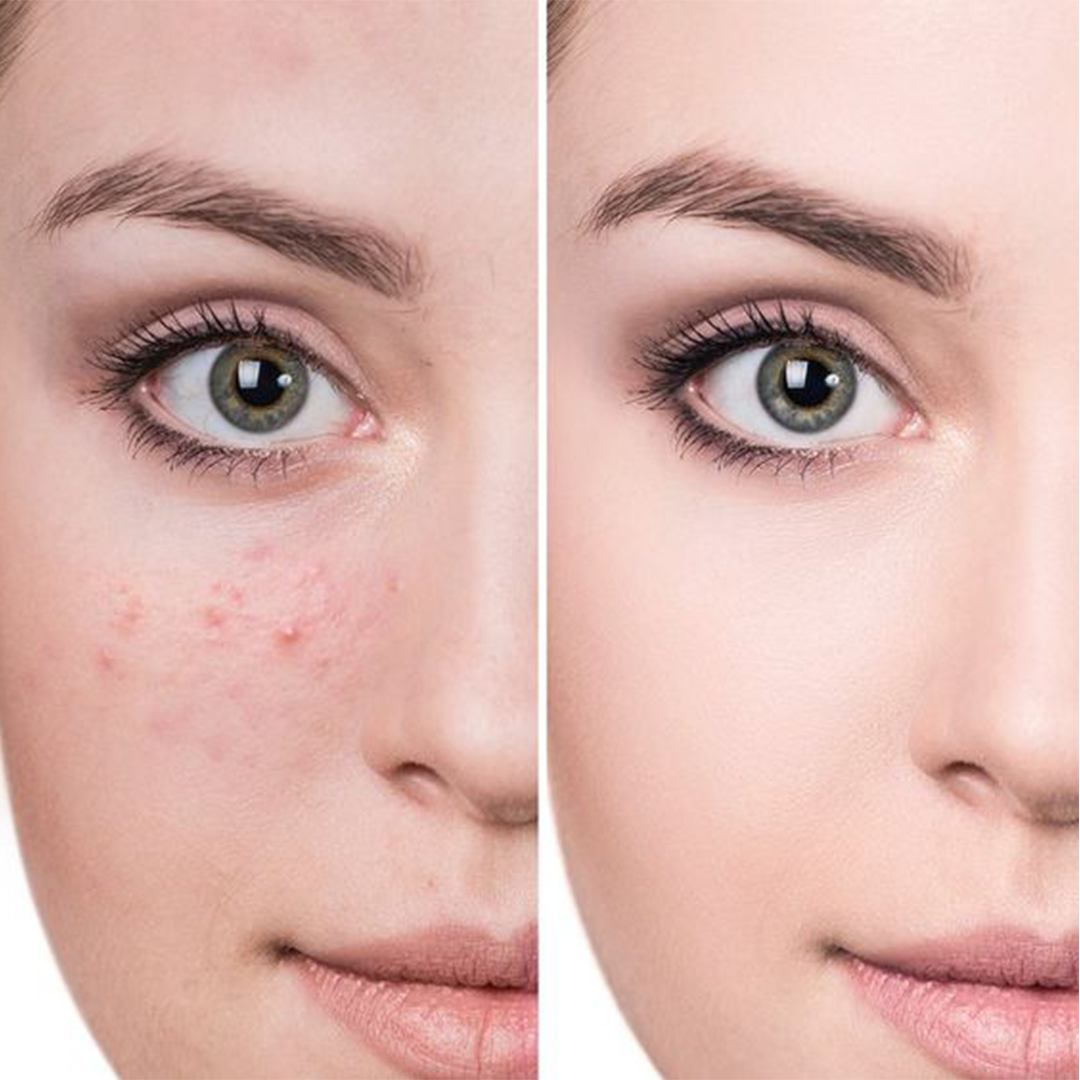Pigmentation Serum & Jasmine Rice Water Face Wash Skin Brightening Combo